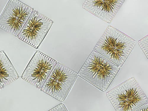 Planteplankton sett i et mikroskop