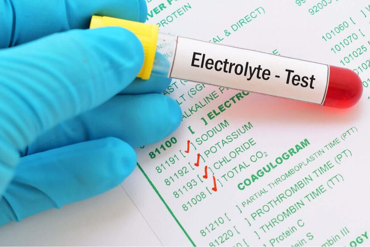 En hånd som holder et prøverør som sier "Elektrolyttest"